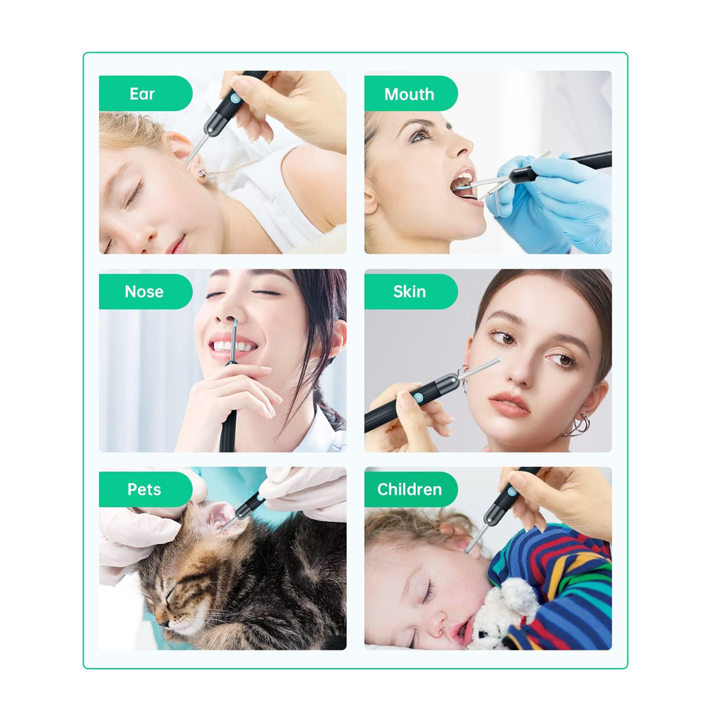 Ear Wax Removal Kit Y8 with Wi-Fi, 2MP Camera,1080P, IP67, Black - Image 3